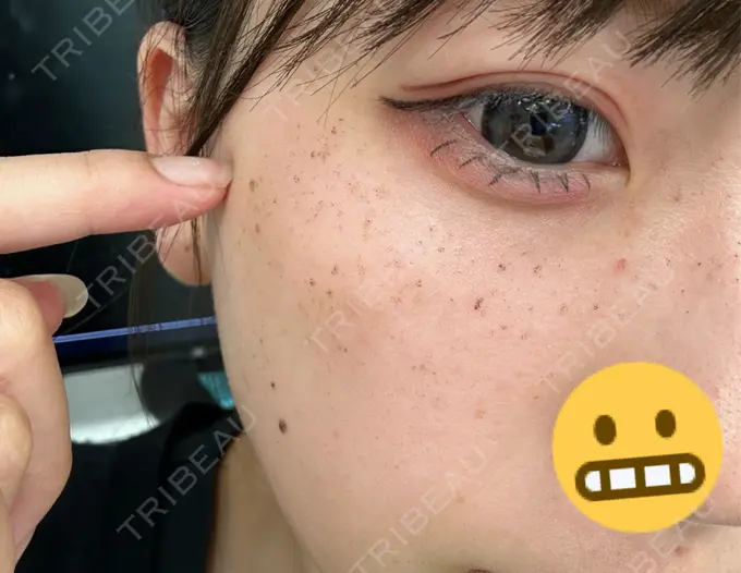 ルメッカ LIBER CLINIC DAY 2 メイン用