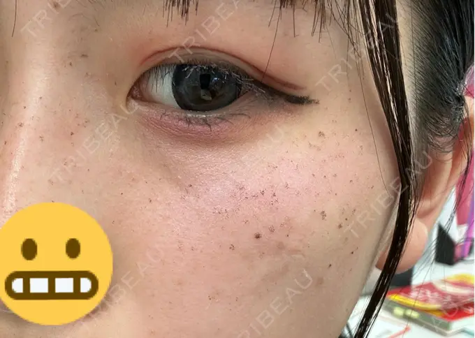 ルメッカ LIBER CLINIC DAY 2 メイン用