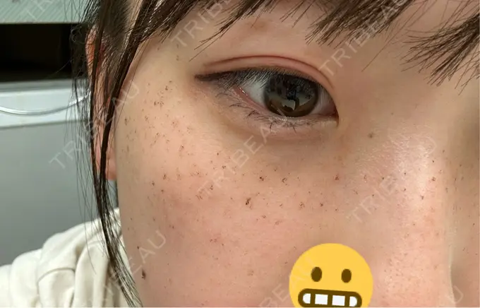 ルメッカ LIBER CLINIC DAY 3 メイン用