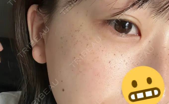 ルメッカ LIBER CLINIC DAY 4 メイン用