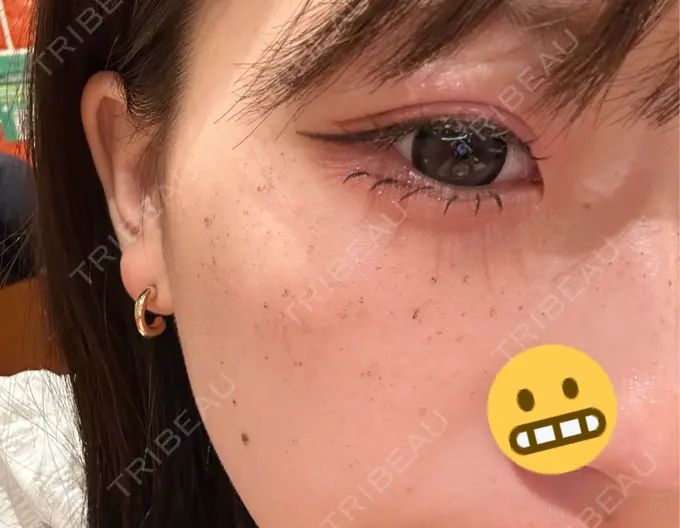 ルメッカ LIBER CLINIC AFTER メイン用