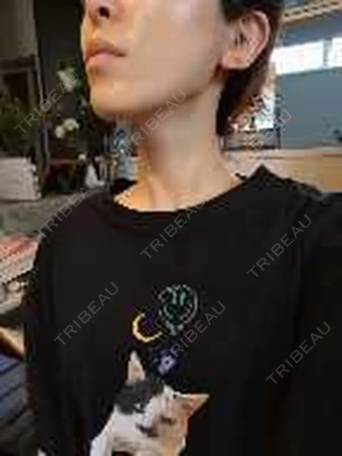 ボトックス（エラ・小顔） / ボトックス（肩） / ボトックス（眉間） / ボトックス（首） Natural Skin Clinic 自由ヶ丘院 AFTER メイン用