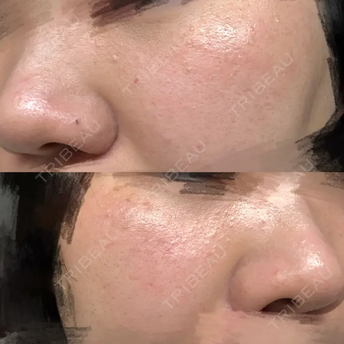 ルメッカ 小倉美容外科/美容皮膚科 ビラビューティークリニック AFTER メイン用