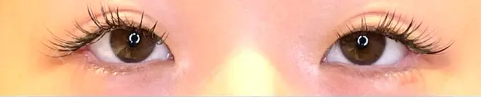 目尻切開 / タレ目形成・グラマラスライン（埋没） LOUIS CLINIC 二子玉川院【ルイクリニック】 AFTER メイン用