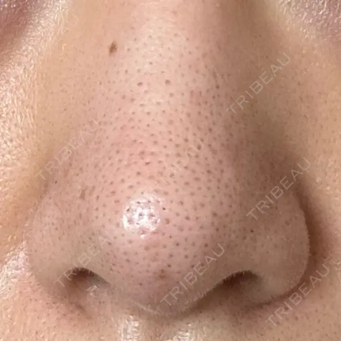 アグネス 日本美容・医療クリニック 六本木院 DAY 1 メイン用