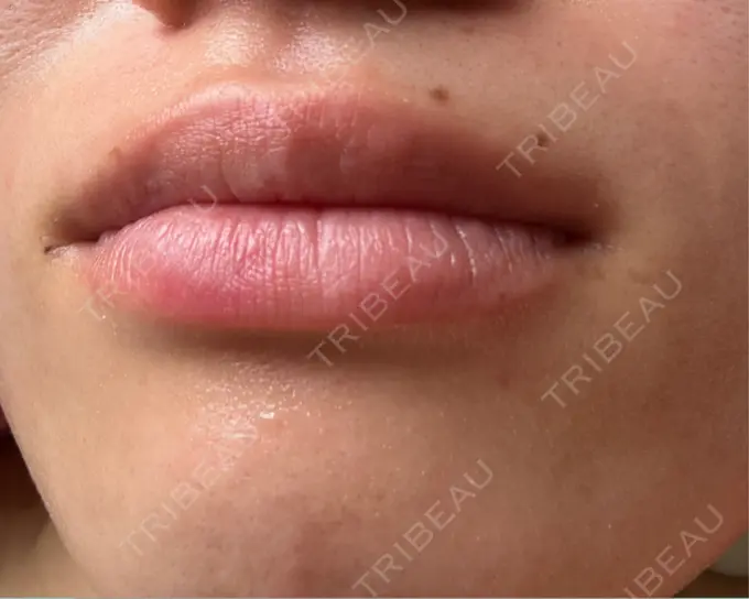 その他 ガーデンクリニック 名古屋院 AFTER メイン用