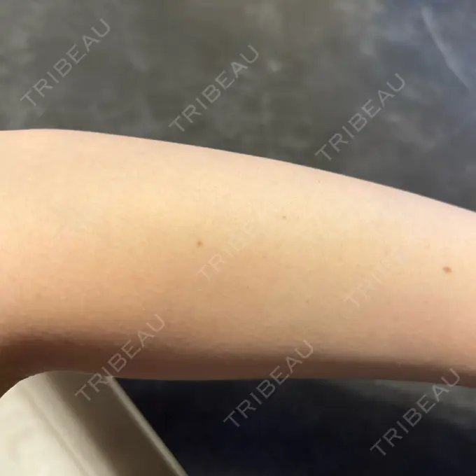 白玉点滴・注射 30クリニック AFTER メイン用