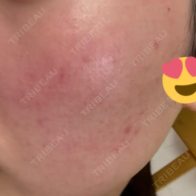 ポテンツァ 表参道メディカルクリニック 表参道院 DAY 0 メイン用