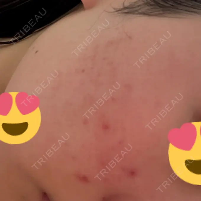 ポテンツァ 表参道メディカルクリニック 表参道院 DAY 1 メイン用