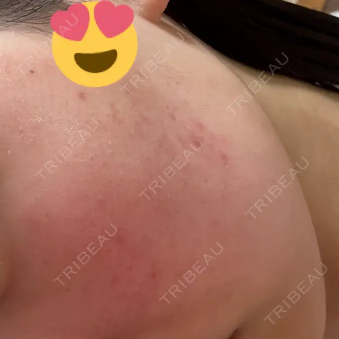 ポテンツァ 表参道メディカルクリニック 表参道院 DAY 1 メイン用