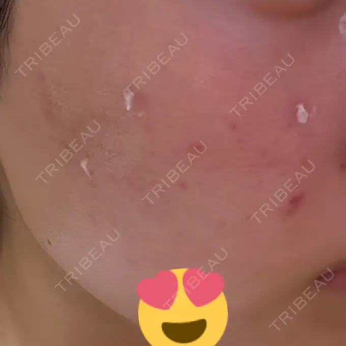 ポテンツァ 表参道メディカルクリニック 表参道院 DAY 2 メイン用