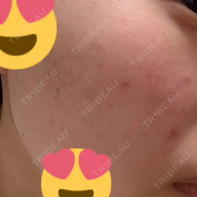 ポテンツァ 表参道メディカルクリニック 表参道院 DAY 3 メイン用