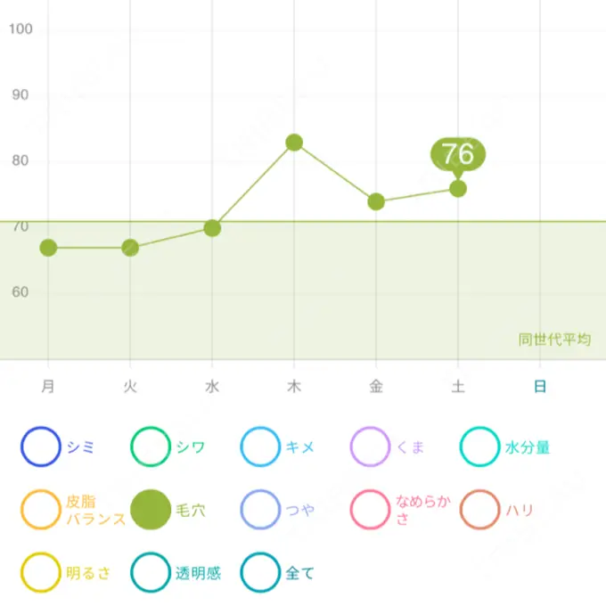 マイクロボトックス 東京シルククリニック 新宿院 DAY 2 メイン用