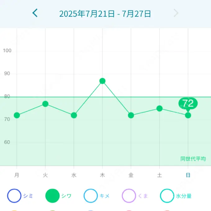 マイクロボトックス 東京シルククリニック 新宿院 DAY 3 メイン用