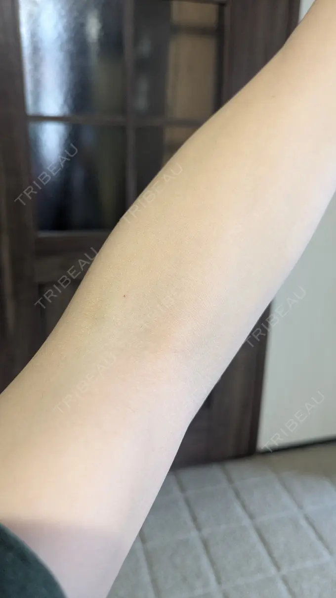 白玉点滴・注射 城本クリニック 名古屋院 AFTER メイン用