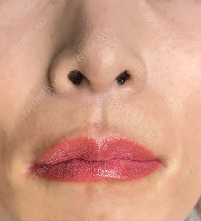 アートメイク（唇） TRUE DESIGN CLINIC AFTER メイン用