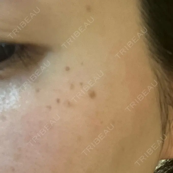 ルメッカ Grias clinic （ジリアスクリニック） DAY 1 メイン用