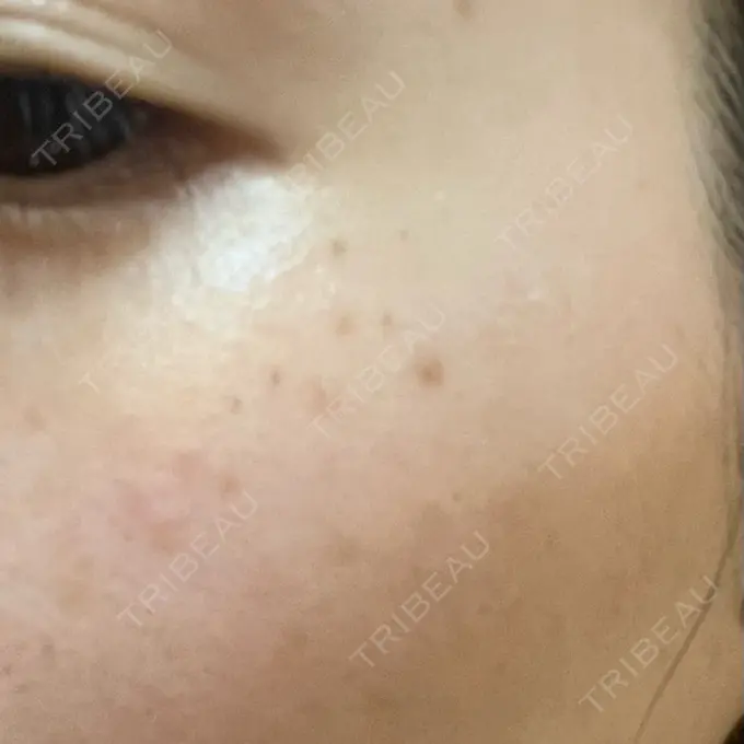 ルメッカ Grias clinic （ジリアスクリニック） DAY 2 メイン用