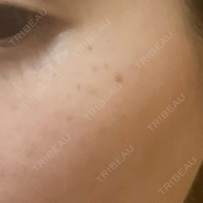 ルメッカ Grias clinic （ジリアスクリニック） DAY 3 メイン用