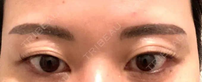 アートメイク（眉） ルーチェクリニック 銀座院 DAY 3 メイン用