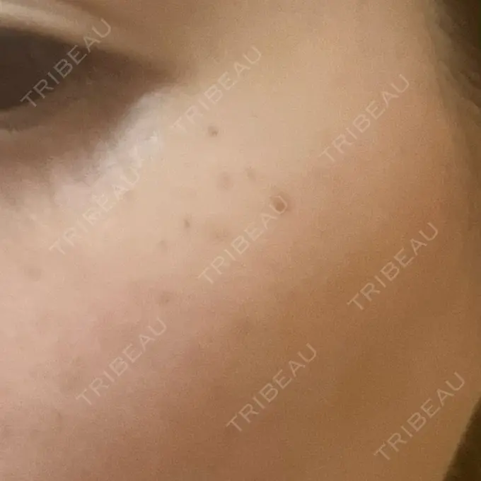 ルメッカ Grias clinic （ジリアスクリニック） DAY 4 メイン用