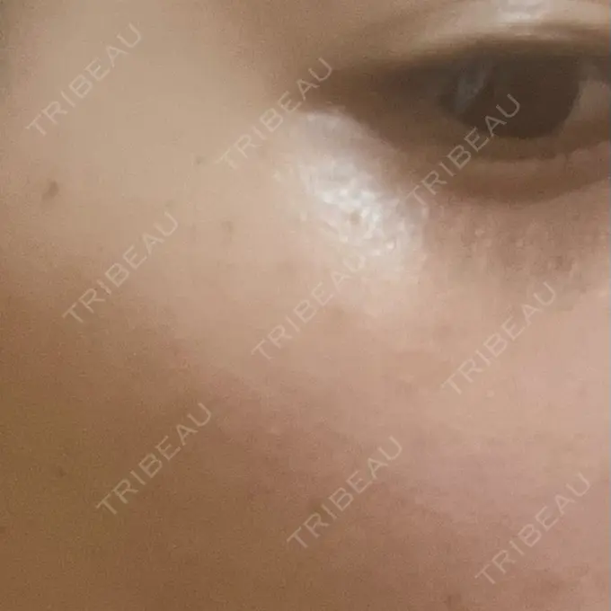 ルメッカ Grias clinic （ジリアスクリニック） DAY 4 メイン用