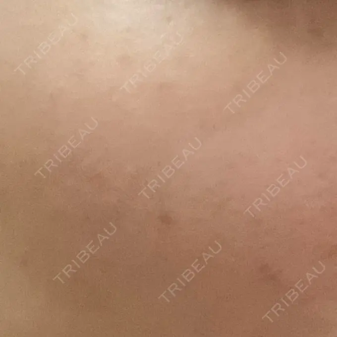 ルメッカ Grias clinic （ジリアスクリニック） DAY 5 メイン用