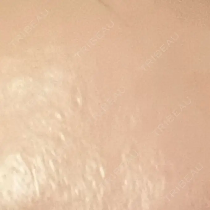 高濃度ビタミンC点滴 新宿美容外科ネビュラクリニック DAY 3 メイン用