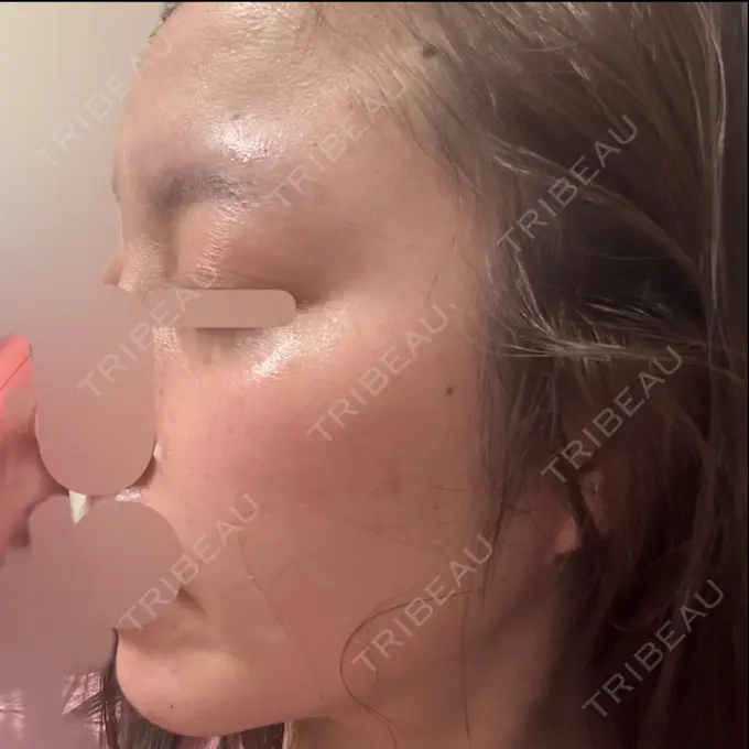 インディバ（顔） Casa de GRACIA GINZA 【カーサデグラシアギンザ】 DAY 25 メイン用