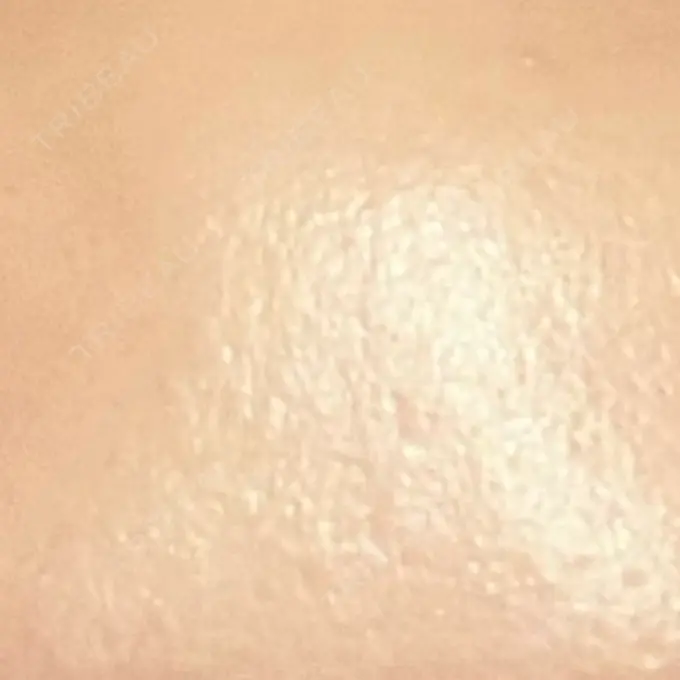 高濃度ビタミンC点滴 新宿美容外科ネビュラクリニック AFTER メイン用