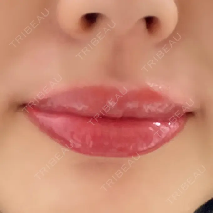 アートメイク（唇） ルーチェクリニック 銀座院 DAY 0 メイン用