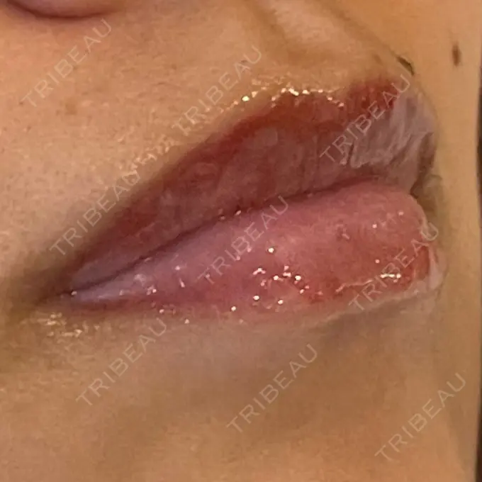 アートメイク（唇） LEAGRANT CLINIC 中目黒 DAY 4 メイン用