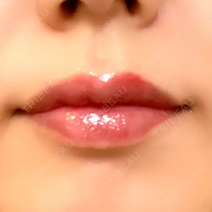 アートメイク（唇） ルーチェクリニック 銀座院 DAY 1 メイン用