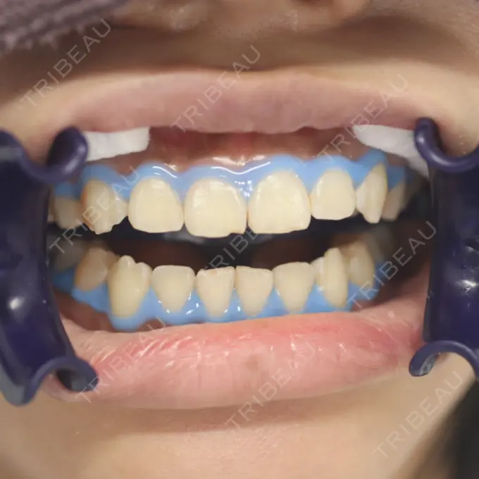 その他 目黒まついデンタルクリニック AFTER メイン用