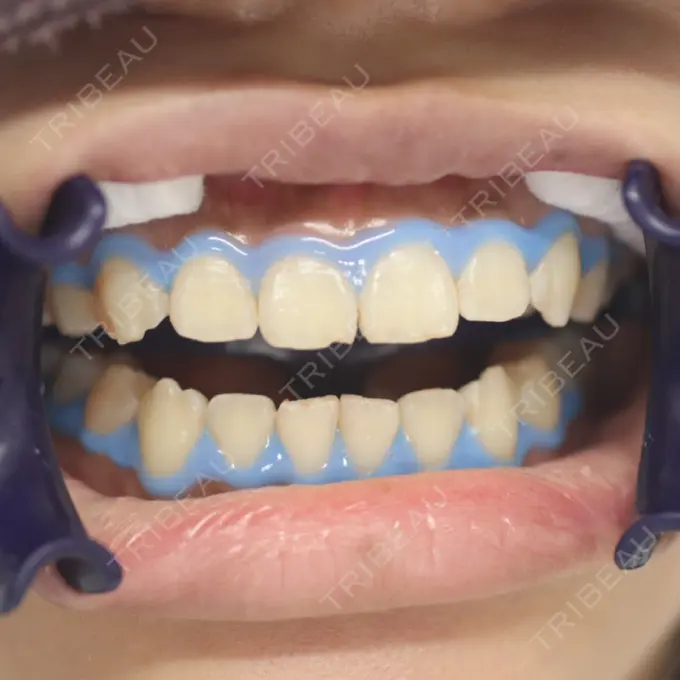 その他 目黒まついデンタルクリニック DAY 0 メイン用