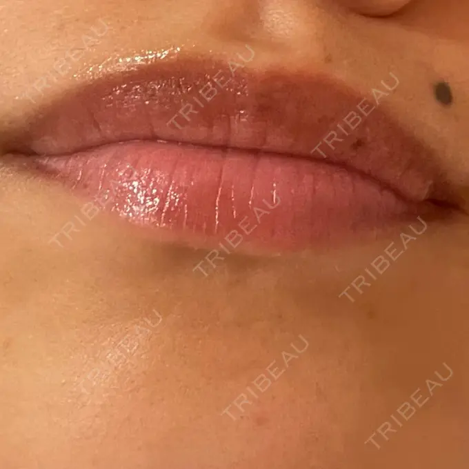 アートメイク（唇） LEAGRANT CLINIC 中目黒 DAY 7 メイン用