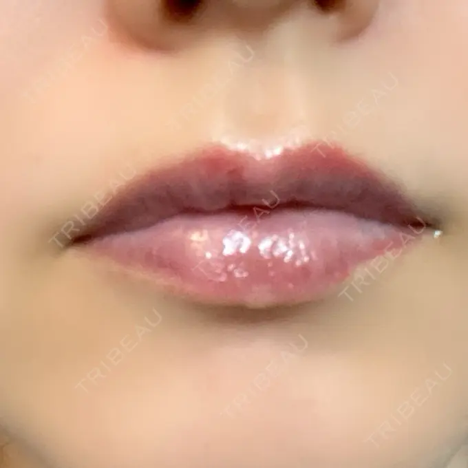 アートメイク（唇） ルーチェクリニック 銀座院 AFTER メイン用