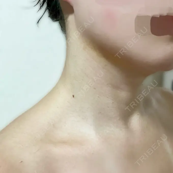 その他（肌） ルラ美容クリニック 仙台院 / ルラスキンクリニック 仙台院 AFTER メイン用