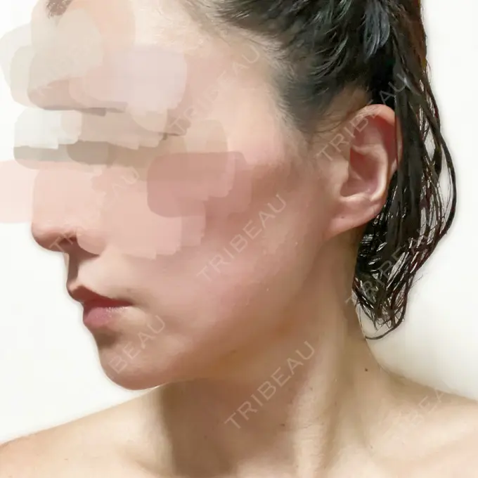 その他（肌） ルラ美容クリニック 仙台院 / ルラスキンクリニック 仙台院 DAY 3 メイン用