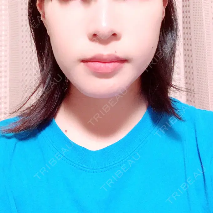 セットバック 大塚美容形成外科・歯科 大塚本院 AFTER メイン用