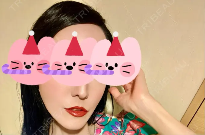 ハイフ（顔） / 光治療（フォトフェイシャルなど） 新宿美容外科クリニック 新宿院 AFTER メイン用