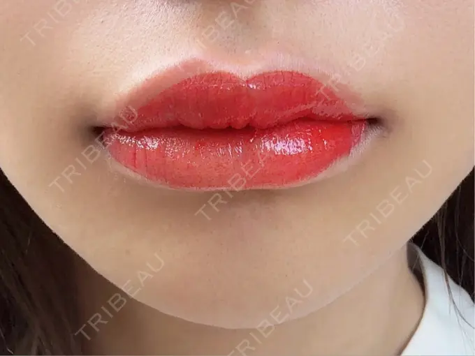 アートメイク（唇） 筋肉・美容クリニック DAY 0 メイン用