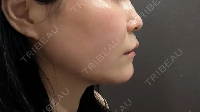 シワ取りボトックス / ボトックス（眉間） / ボトックス（額） / ハイフ（顔） / 美肌レーザー / シミ取りレーザー / 美白レーザー / ピコレーザートーニング（美白・肝斑） / レーザートーニング（美白・肝斑） LE CLINIC DAY 0 メイン用