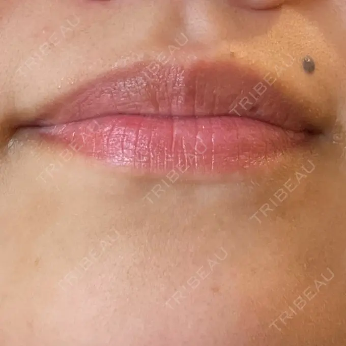 アートメイク（唇） LEAGRANT CLINIC 中目黒 AFTER メイン用