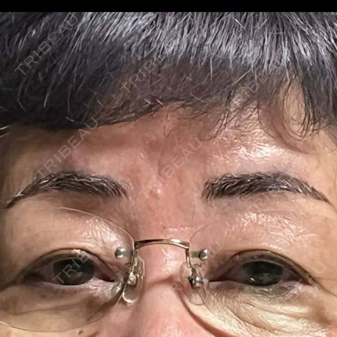 アートメイク（眉） 共立美容外科 福岡院 AFTER メイン用