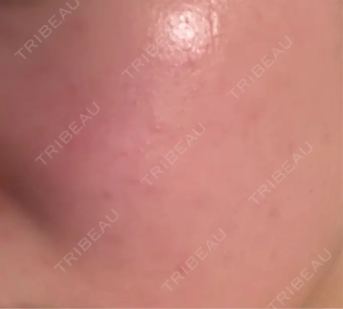 ルメッカ Grias clinic （ジリアスクリニック） DAY 1 メイン用