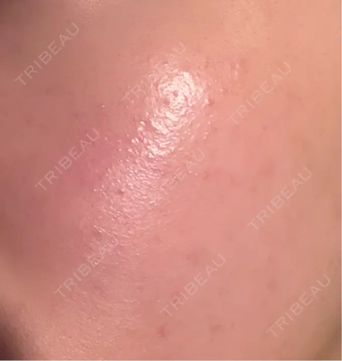 ルメッカ Grias clinic （ジリアスクリニック） DAY 3 メイン用