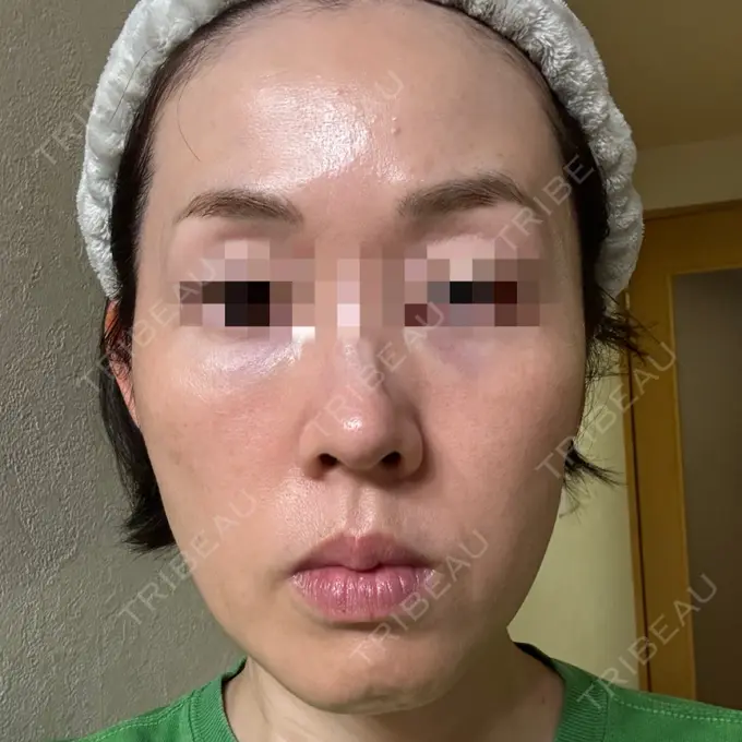 美容点滴・美容注射（美肌） / 白玉点滴・注射 / 美肌レーザー / シミ取りレーザー / 美白レーザー / ピコレーザートーニング（美白・肝斑） / レーザートーニング（美白・肝斑） LE CLINIC DAY 0 メイン用