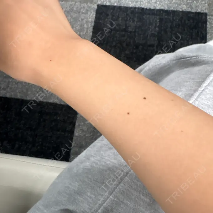 白玉点滴・注射 城本クリニック 名古屋院 AFTER メイン用