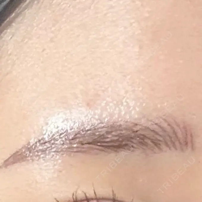 アートメイク（眉） 平和台皮フ科 DAY 1 メイン用